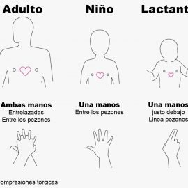 RCP Pediátrica: diferencias entre bebés, niños y adolescentes