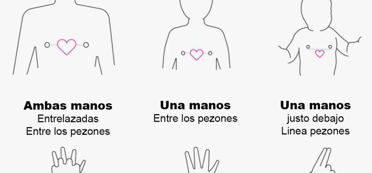 RCP Pediátrica: diferencias entre bebés, niños y adolescentes